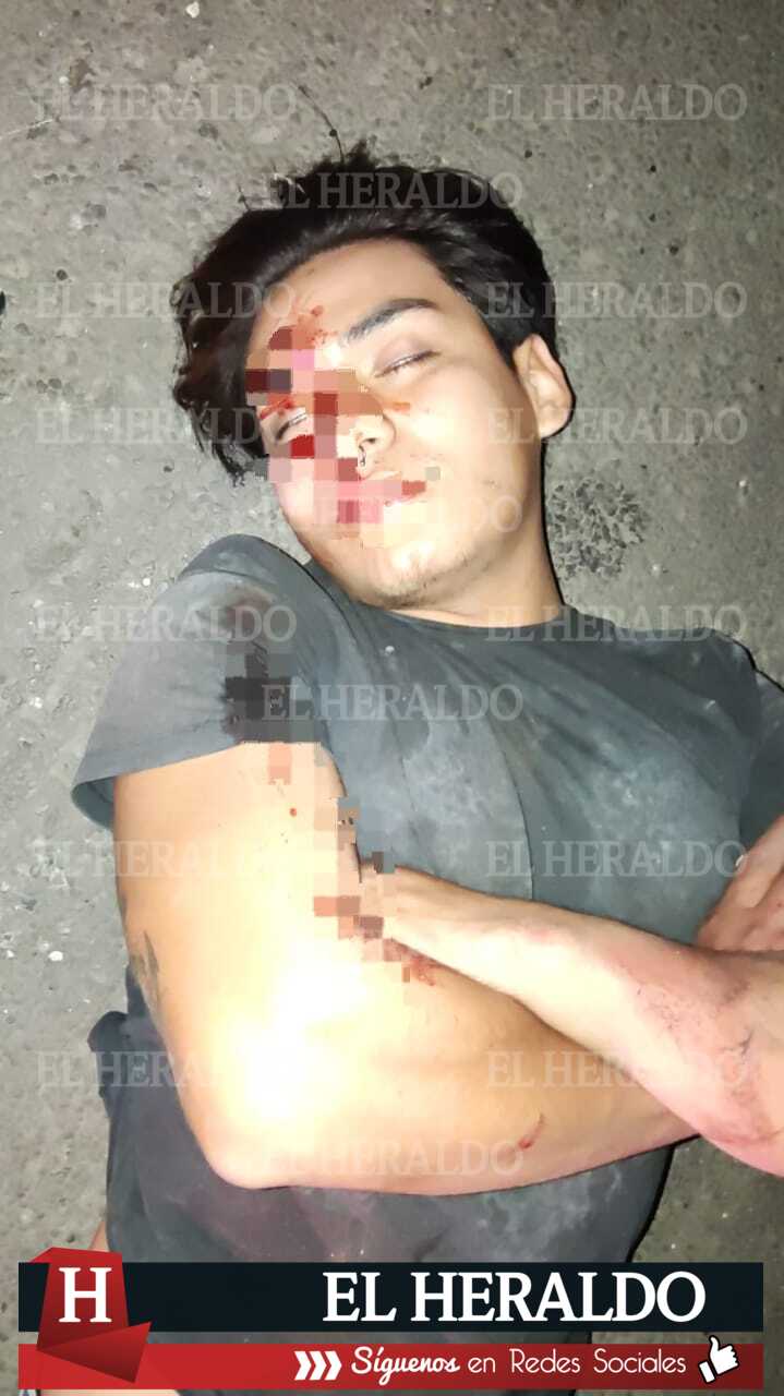 Motociclista impactado por camioneta 5